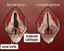 laryngeal