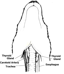 thyroid tumors