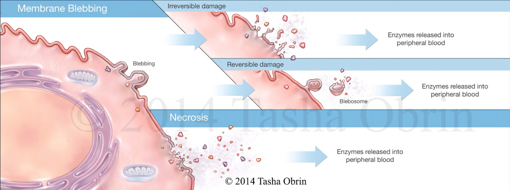 Liver Enzymes Gone Awry It's Not Always The Liver's Fault