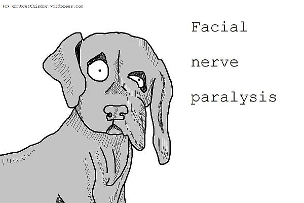 facial nerve paralysis