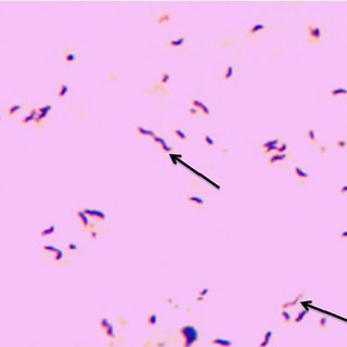 campylobacteriosis