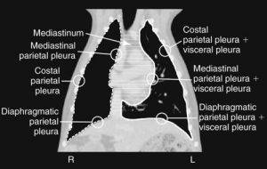 Thymoma in Cats & Dogs - An Important Cancer - CriticalCareDVM